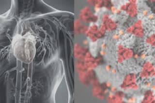 COVID-19-induced cardiovascular complications