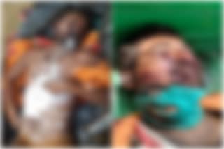 2 youth died in road accident in garhwa