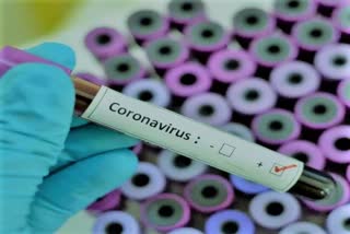 rudrapur corona virus latest updates, रुद्रपुर उधम सिंह नगर कोरोना समाचार
