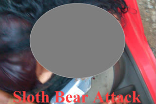 Sloth bear attacks, blinds woman in Karnataka