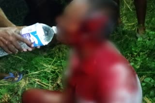 son-deadly-attack-on-father-in-raichuru