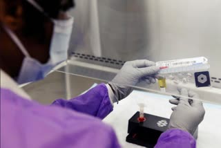 Experimental COVID-19 test detects coronavirus in 10 minutes