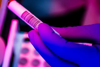 Senior ICMR SCIENTIST TESTS CO ID POSITIVE  ICMR  ഐസിഎംആര്‍ ഗവേഷകന് കൊവിഡ് 19 സ്ഥിരീകരിച്ചു  ഐസിഎംആര്‍  കൊവിഡ് 19  ന്യൂഡല്‍ഹി  covid latest news  icmr latest news