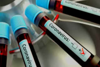 Pennsylvania researchers create database to categorize promising leads for defeating coronavirus