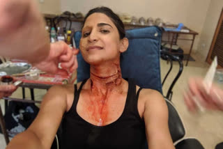 Betaal: Aahana Kumra on wearing prosthetics for 45-odd days