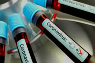 six new corona patient found in palamu, corona positive cases in Palamu, corona positive cases in jharkhand, पलामू में कोरोना के छह नए मामले, झारखंड में कोरोना पॉजिटिव केस, पलामू में कोरोना मरीजों की संख्या