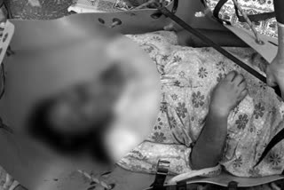 Suicide of a young woman with abdominal pain in Baliparru Krishna District