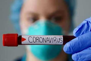 8985 new cases of corona infection in Russia