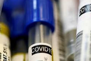 45 new COVID-19 cases  2 deaths reported in Indore  കൊവിഡ്-19  ഇന്തോറില്‍ 45 പേര്‍ക്ക് കൂടി  കൊവിഡ്  രണ്ട് മരണം  മധ്യപ്രദേശ് കൊവിഡ് വാര്‍ത്ത