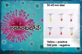 corona diagnostic test in an half an hour with rt lamp procedure