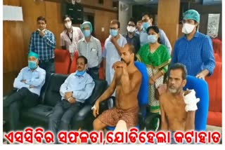 success-of-scb-plastic-surgery-specialists-severed-hand-can-re-attached