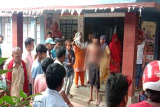 young man burn while making tiktok video in sahibganj, News of mirzachaoki railway station, young man caught in high tension wire in sahibganj, साहिबगंज में टिक टॉक वीडियो बनाने के दौरान झुलसा युवक, मिर्जाचौकी रेलवे स्टेशन की खबरें, हाई टेंशन तार की चपेट में आया युवक