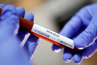 7040 people got corona antigen test on the first day in delhi