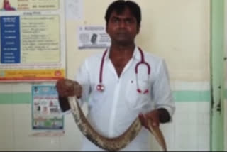 snake catches farmers