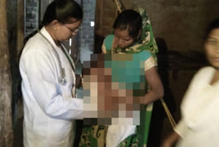 one month baby girl clicked over body due to superstiion in melghat amravati