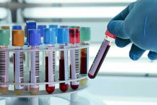 private labs charged large amount for corona testing in mumbai