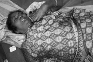 bike-hit-a-lady-and-died-in-nellore-district