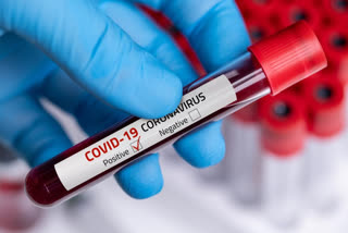 positive for COVID-19 swine flu recovers at Hyderabad hospital high risk co-morbidities 59-yr-old with COVID-19 Percutaneous transluminal coronary angioplasty തെലങ്കാന ഹൈദരാബാദ് കൊവിഡ് 19 എച്ച് 1 എൻ 1