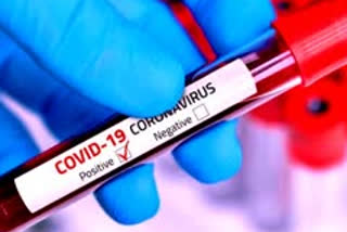 Covid proliferation; District medical officer to wear mask properly  Covid proliferation  കൊവിഡ് വ്യാപനം  ജില്ലാ മെഡിക്കൽ ഓഫീസർ  കൊവിഡ് വ്യാപനം; മാസ്ക് ശരിയായ രീതിയിൽ ധരിക്കണമെന്ന് അധികൃതർ