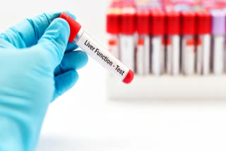 Blood test for liver health