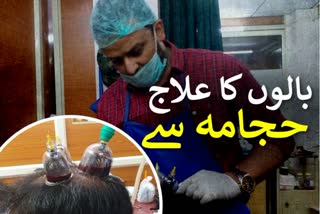 hair treatment through hijama
