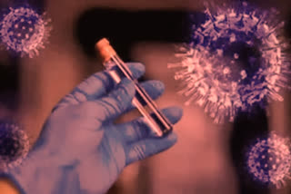 54 people die of coronavirus in state