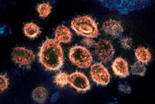 Rocky Mountain Laboratories shows SARS-CoV-2 virus particles which causes COVID-19, isolated from a patient in the U.S., emerging from the surface of cells cultured in a lab.