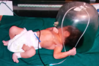 Newborn Baby Girl Found Left in Dustbin at Aligarh