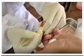 corona-plasma-donor-screening-begins-in-dharavi