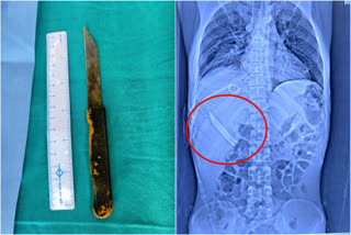 20-cm Knife Removed From Man