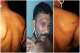 assaulted by the police  തിരുവനന്തപുരം  ശ്രീനാരായണപുരം  കന്യാകുളങ്ങര  thiruvanathapuram  pothancode