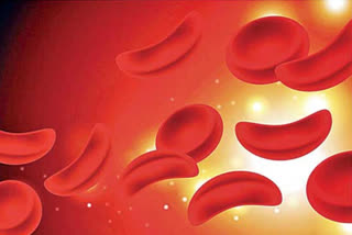 sickle cell