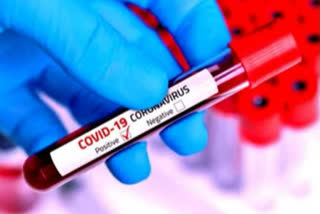 Covid19 lab attendant tested positive