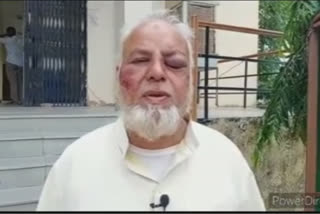 Auto driver assaulted for not chanting Jai Shri Ram