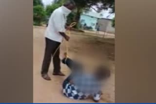 Boy beaten hardly by his Uncle