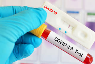 A NEW DRUG FOR THE TREATMENT OF COVID