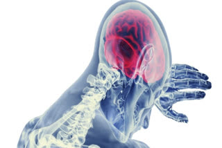 Brain Injury, Managing Brain injury, understanding brain injury
