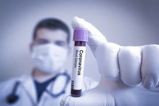 1 lakh coronavirus tests on 1 million in Gurugram