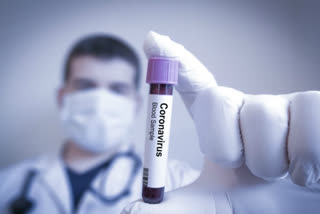 1 lakh coronavirus tests on 1 million in Gurugram