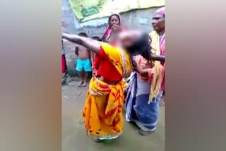 Bengal Woman allegedly beaten by shaman