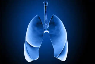 Scientists Decode How Lungs are Damaged in Severe Covid-19 Using Novel 3D Imaging Technique