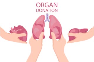 Lung transplant