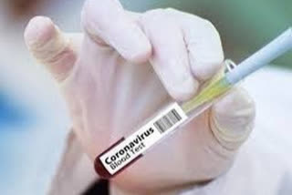 160 new covid positive cases reported in kottayam district  കോട്ടയം ജില്ലയില്‍ 160 പേര്‍ക്ക് കൂടി കൊവിഡ്  covid positive cases reported in kottayam district  covid updates  kottayam news  കൊവിഡ് കോട്ടയം