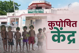 malnutrition centre closed for more than two years in dhanbad