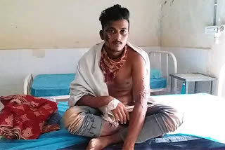 Young lady attacks her lover with acid! acid attack Crime abusive relations Woman Boyfriend Marry Acid Kurnool district Nandyala காதலன் மீது திராவகம் வீசிய காதலி ஆந்திரா திராவகம் வீச்சு இளைஞர் மீது திராவகம் வீச்சு