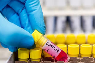 Private hospital reports first case of coronavirus reinfection in Bengaluru