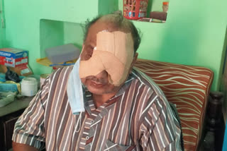 Hyderabad: One man face injured by China manja