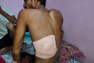 Young man stabbed in a mutual dispute in Sangam Vihar