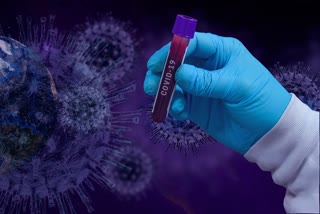 chinese scientist claimed that coronavirus spread from wuhan lab