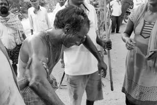 a man injured in fight at maddirala in suryapeta district